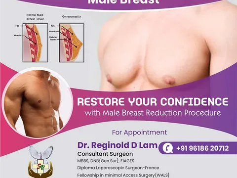 Sathya Veda Medical Center gynaecomastia (male breast reduction) awareness graphic